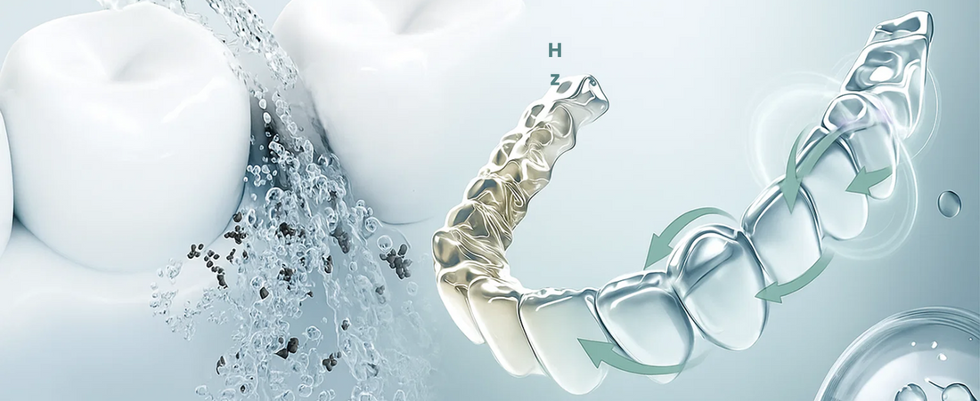 Why I Use an Ultrasonic Retainer Cleaner (and Why You Might Want To, Too)